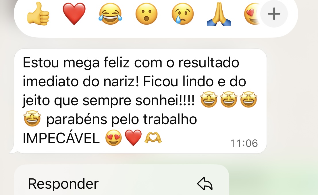 Depoimento no WhatsApp: “Estou mega feliz com o resultado imediato do nariz! Ficou lindo e do jeito que sempre sonhei. Parabéns pelo trabalho impecável.”